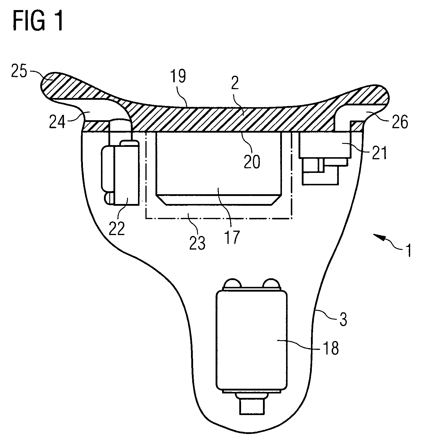 Hearing device with a contact unit and an associated external unit