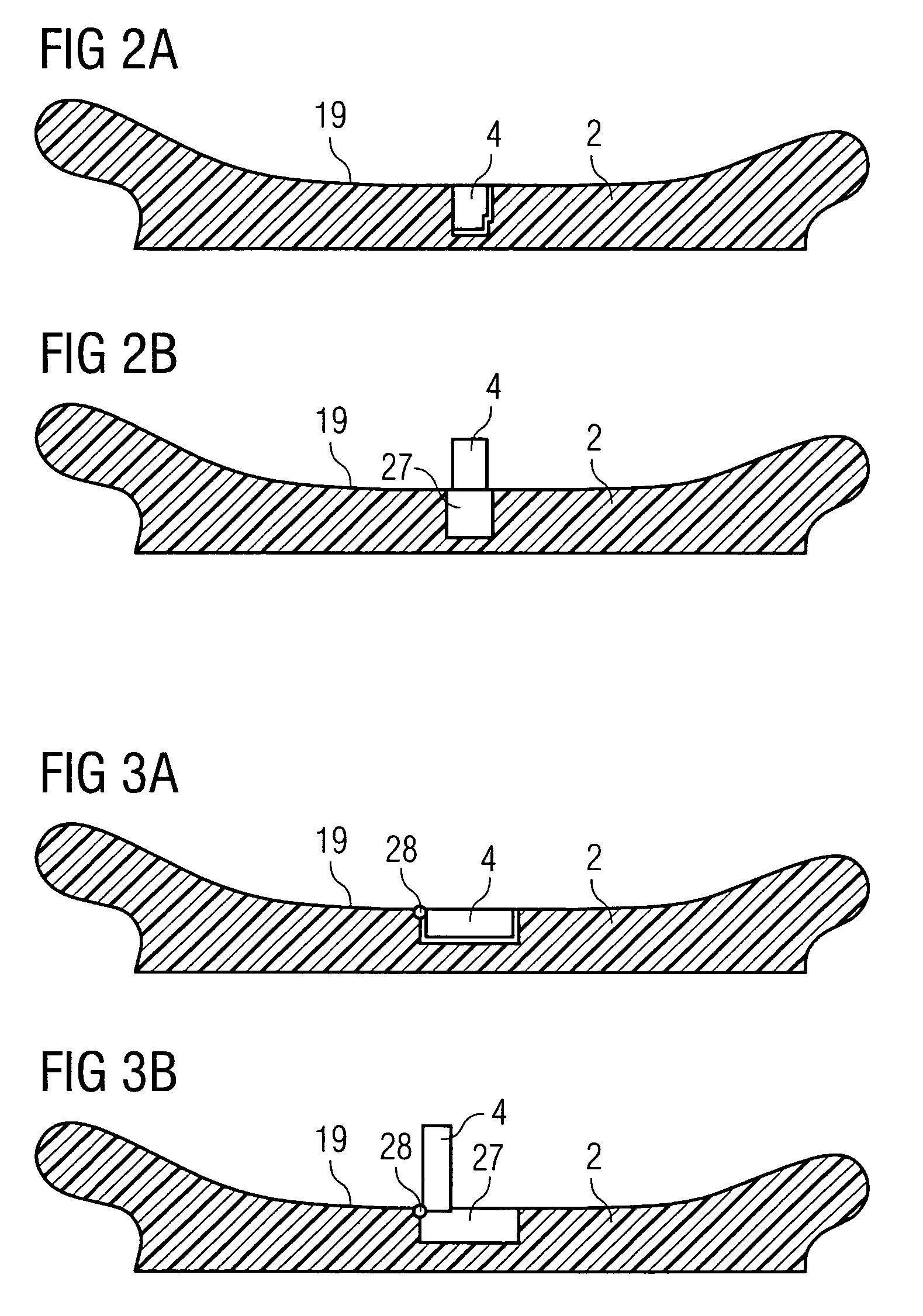 Hearing device with a contact unit and an associated external unit