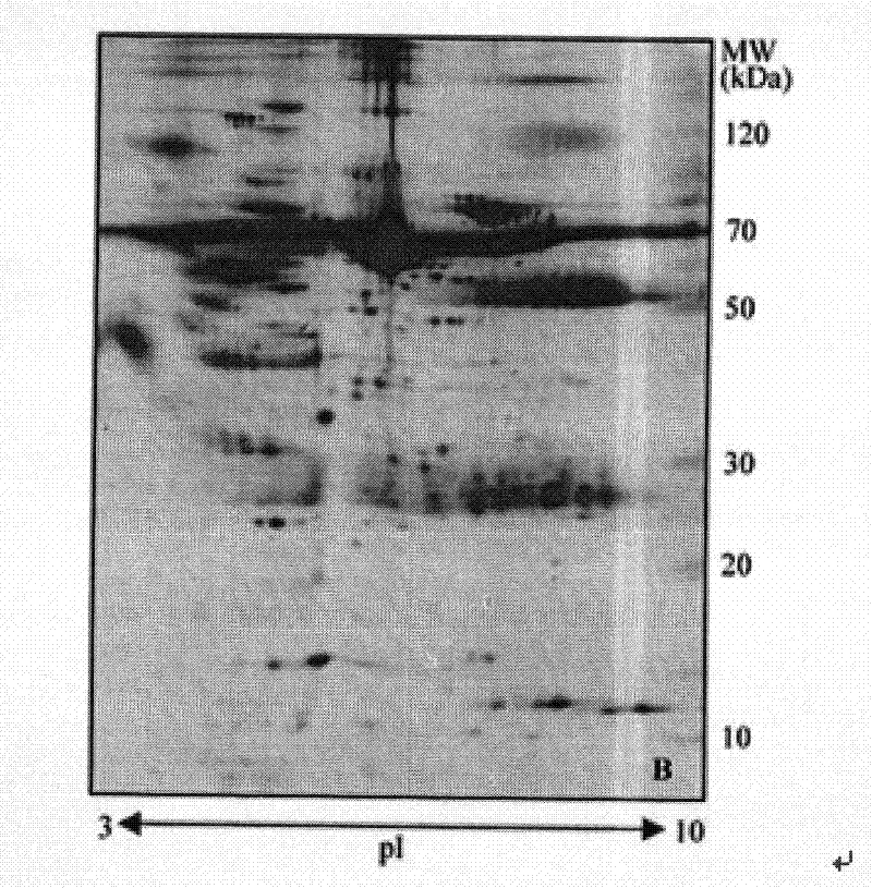 Method for concentrating and desalting urine sample