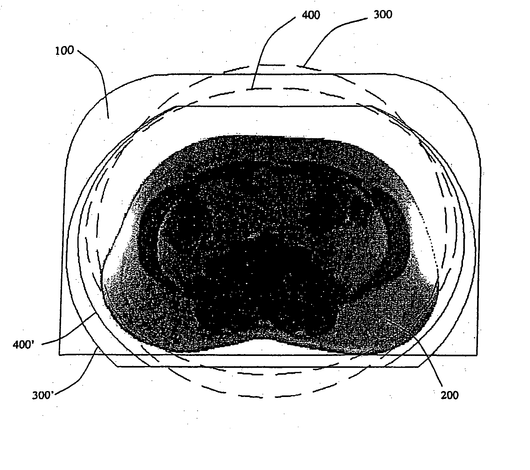 Shimmed magnetic resonance imaging apparatus and shimming method therefor