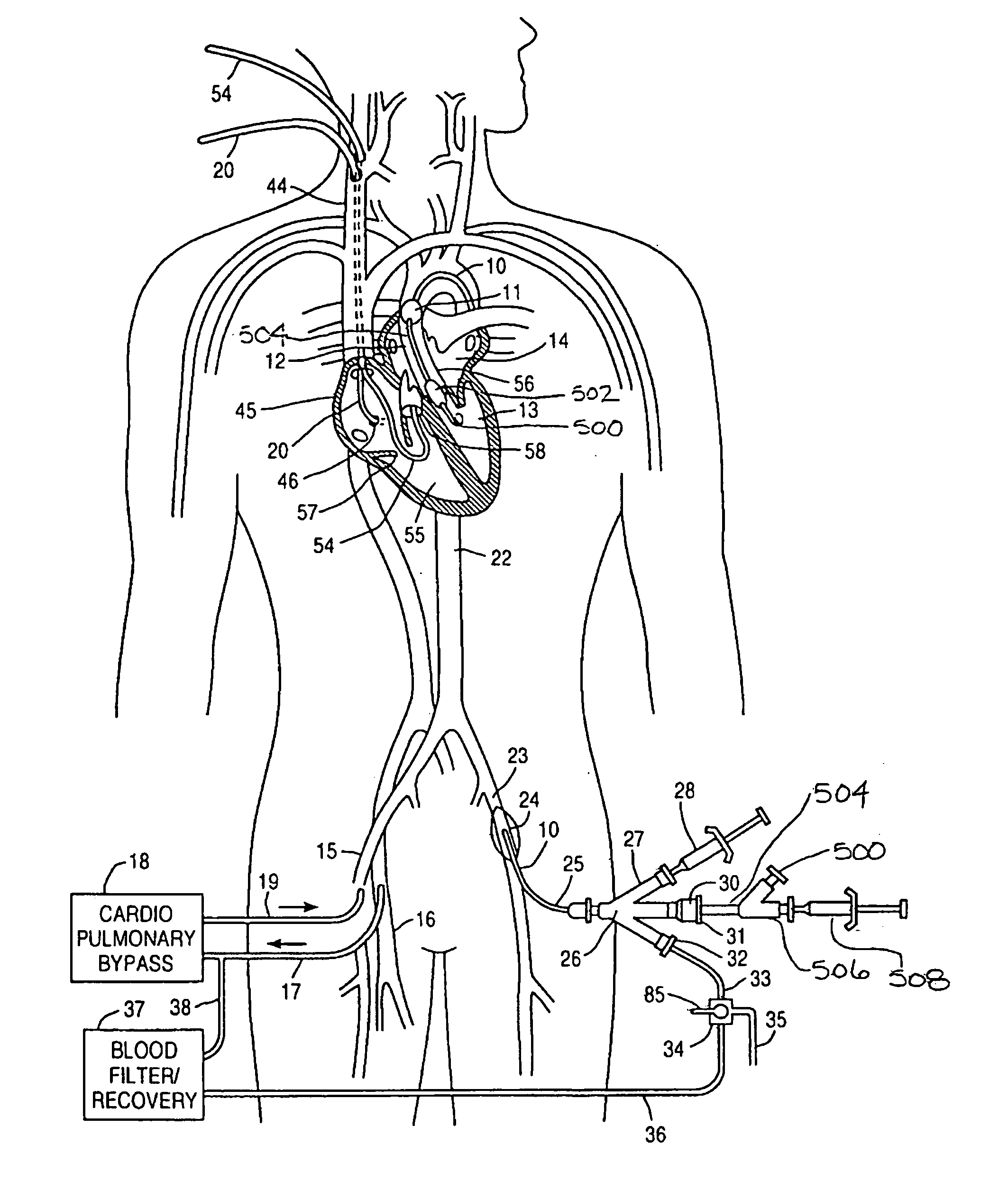 System and methods for performing endovascular procedures