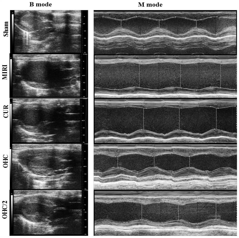 Application of curcumin metabolite in preparation of medicine for treating myocardial ischemia related injury