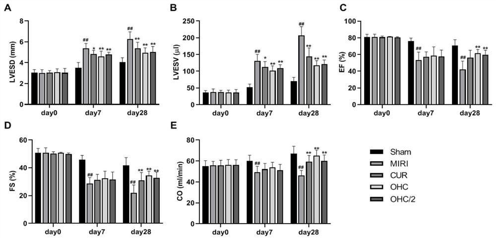 Application of curcumin metabolite in preparation of medicine for treating myocardial ischemia related injury