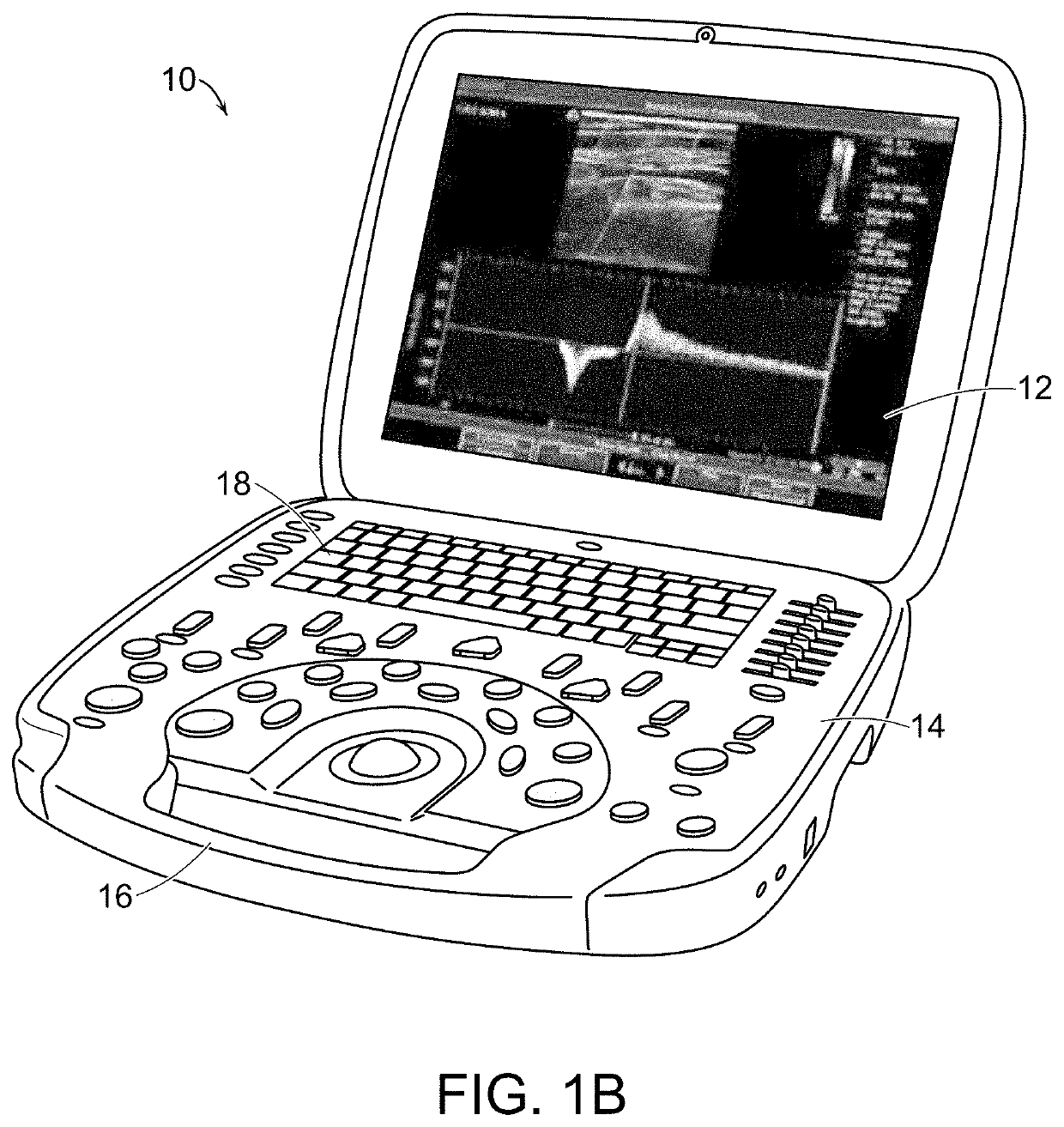 Portable ultrasound system