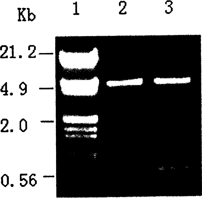 Conotoxin MVII A and Trx fusion protein and its expression and application