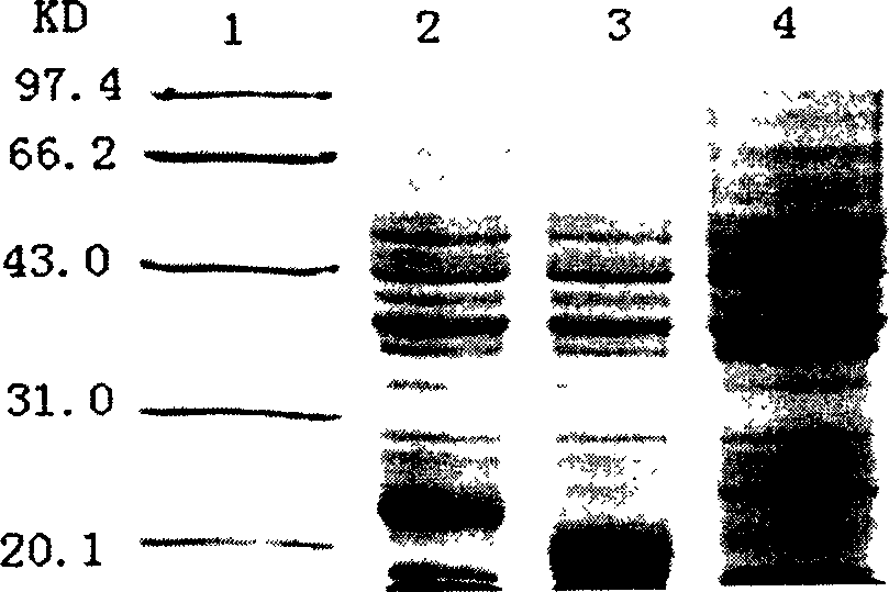 Conotoxin MVII A and Trx fusion protein and its expression and application