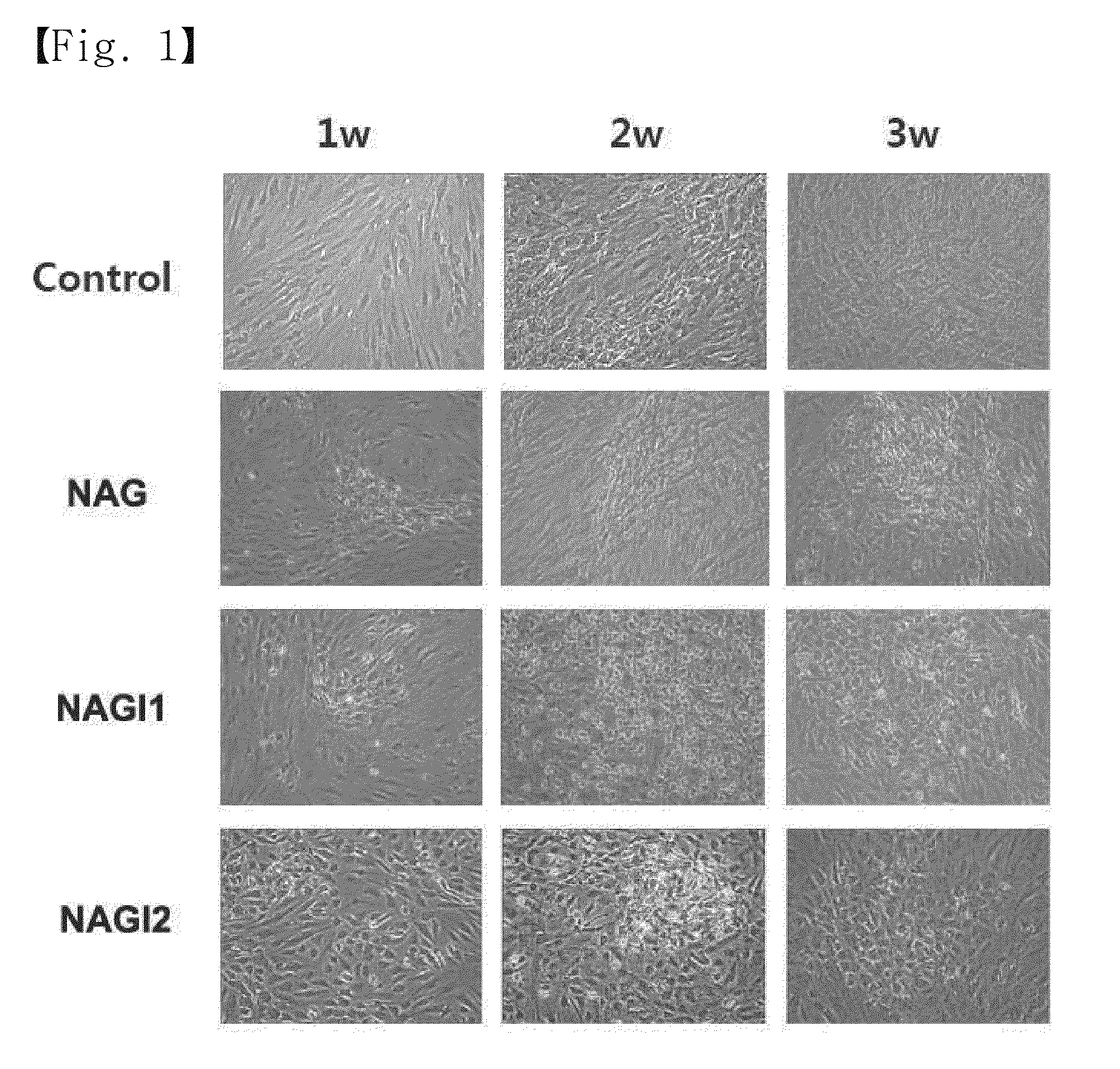 Method for the differentiation of human adult stem cells into insulin-secreting cells
