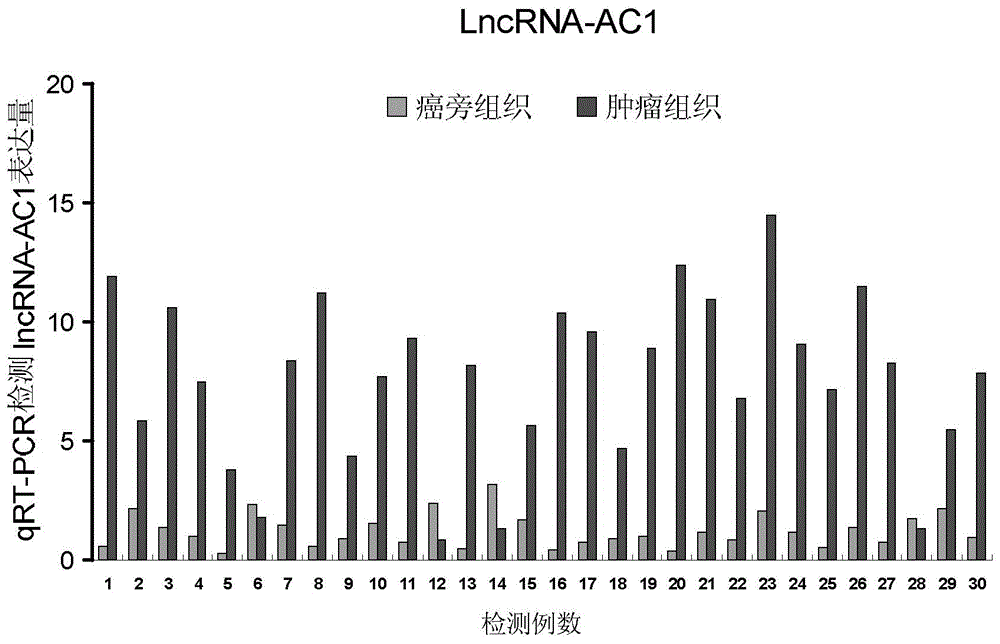 Detection method and application of long-chain non-coded RNA for screening bladder cancer