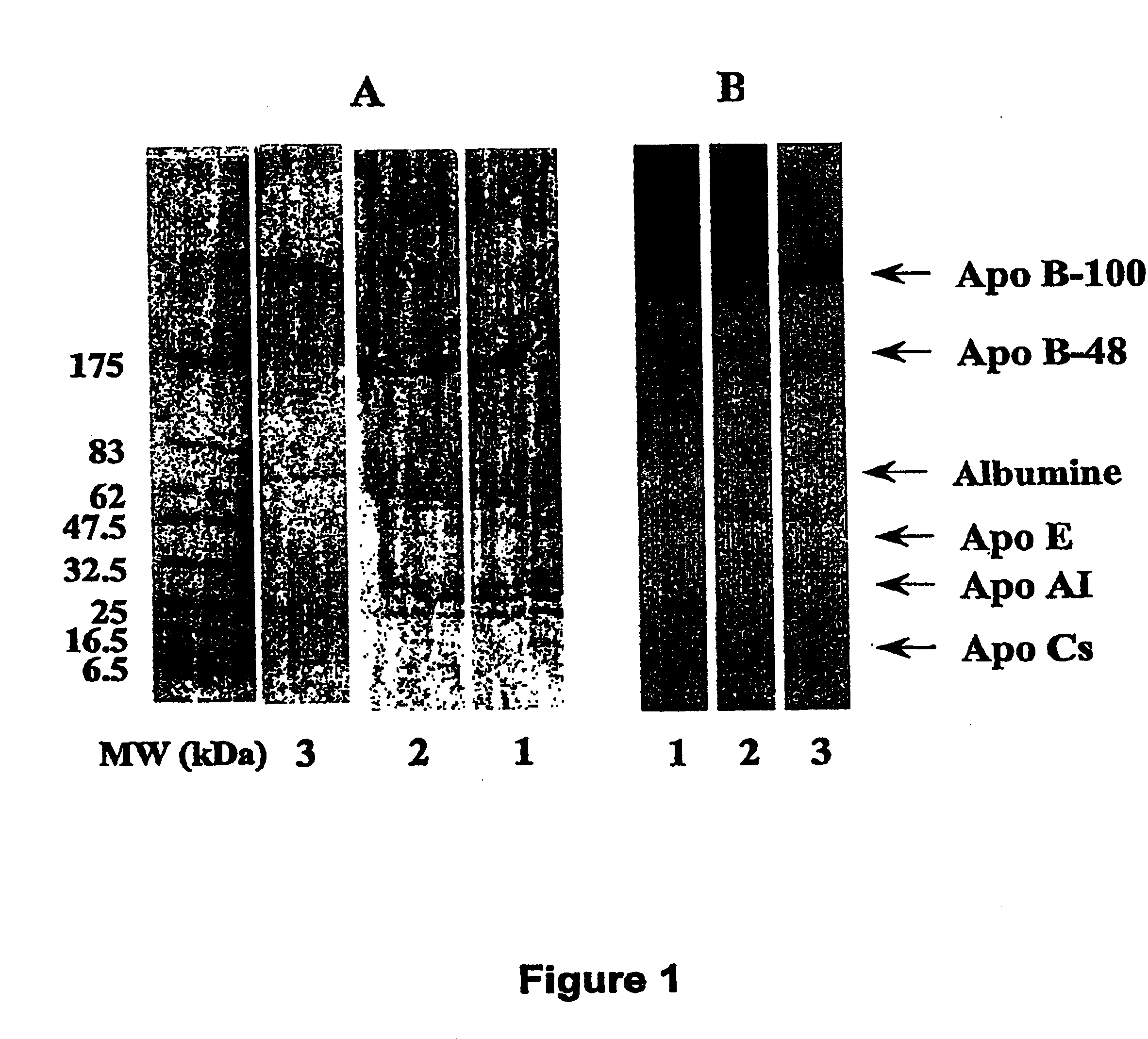 Compositions and methods for apo-b48 and apo-b100 assay