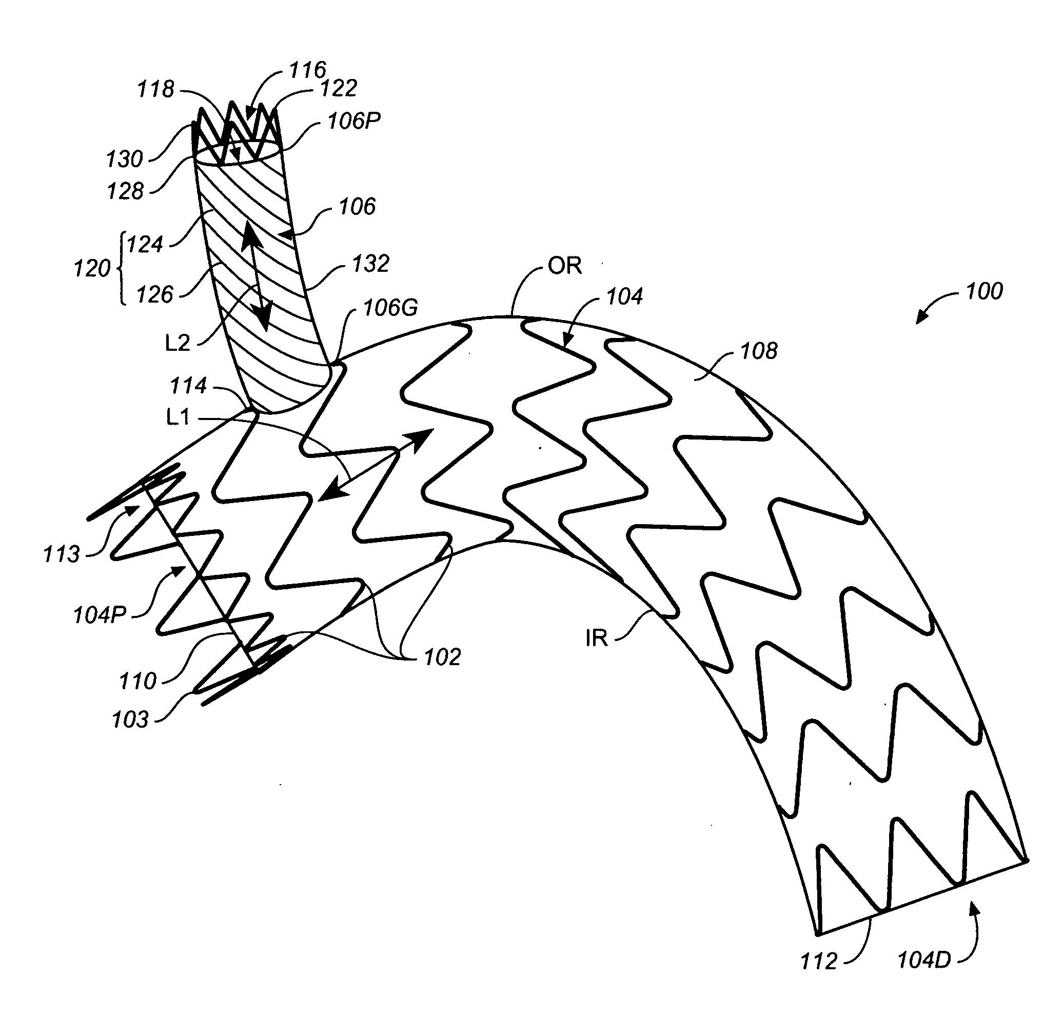 Eversible Branch Stent-Graft and Deployment Method