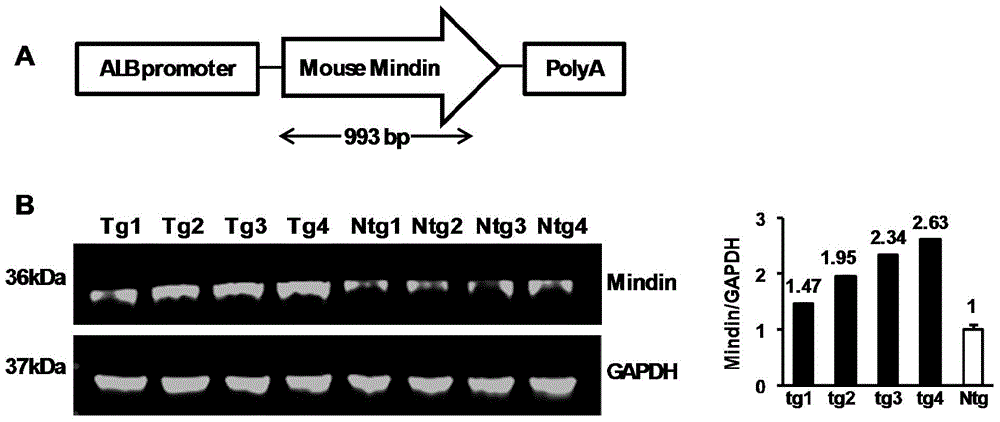 Application of gene Mindin in hepatic ischemia reperfusion injury