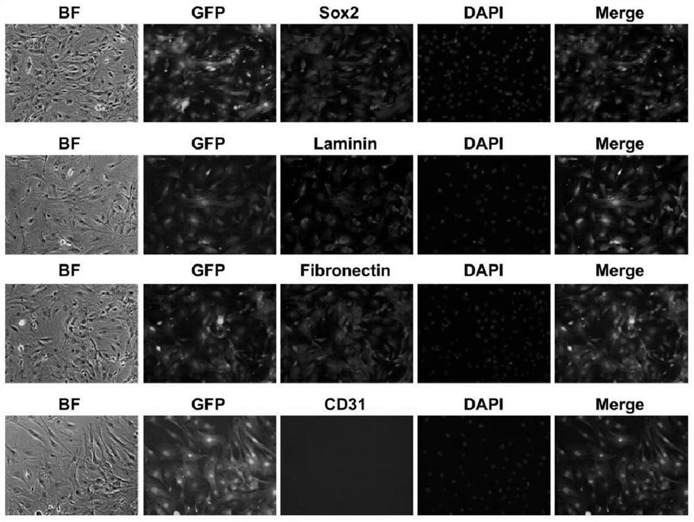 A method for preparing adipose stem cell exosomes, adipose stem cell exosomes and applications thereof