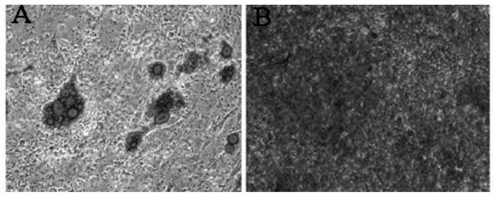 A method for preparing adipose stem cell exosomes, adipose stem cell exosomes and applications thereof