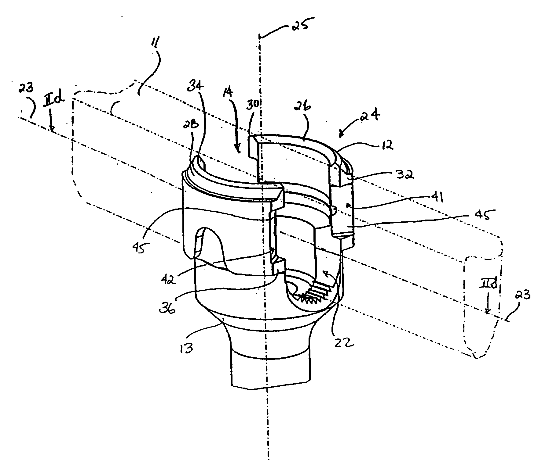 Top loading spinal fixation device and instruments for loading and handling the same