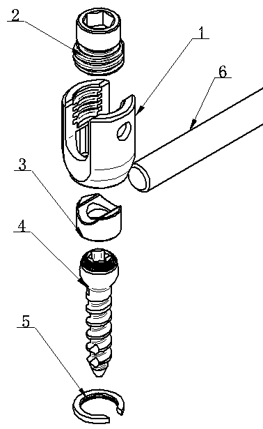 Polyaxial pedicle screw fixing device with self-breaking screw