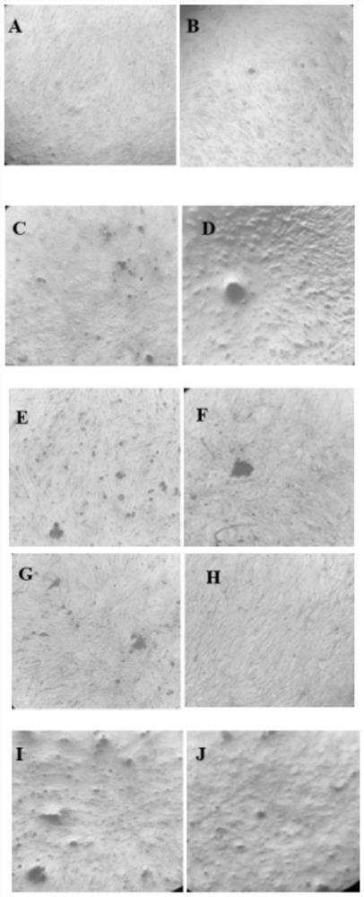 Phosphate ester derivative of herba epimedii as well as preparation method and application of phosphate ester derivative