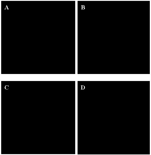 A kind of electrospinning nanofiber-extracellular matrix composite material and its preparation method and application