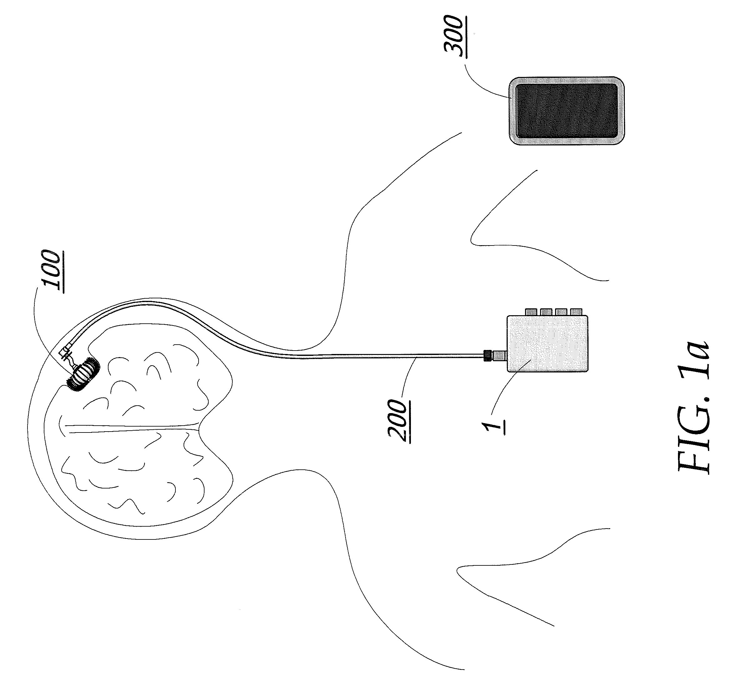 Magnetic breather pump and a method for treating a brain tumor using the same