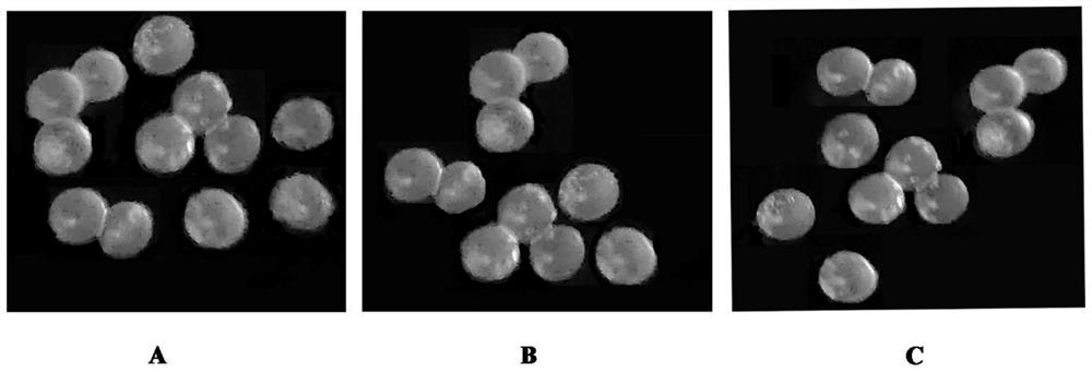 Controllable degradation embryo microsphere and preparation method thereof