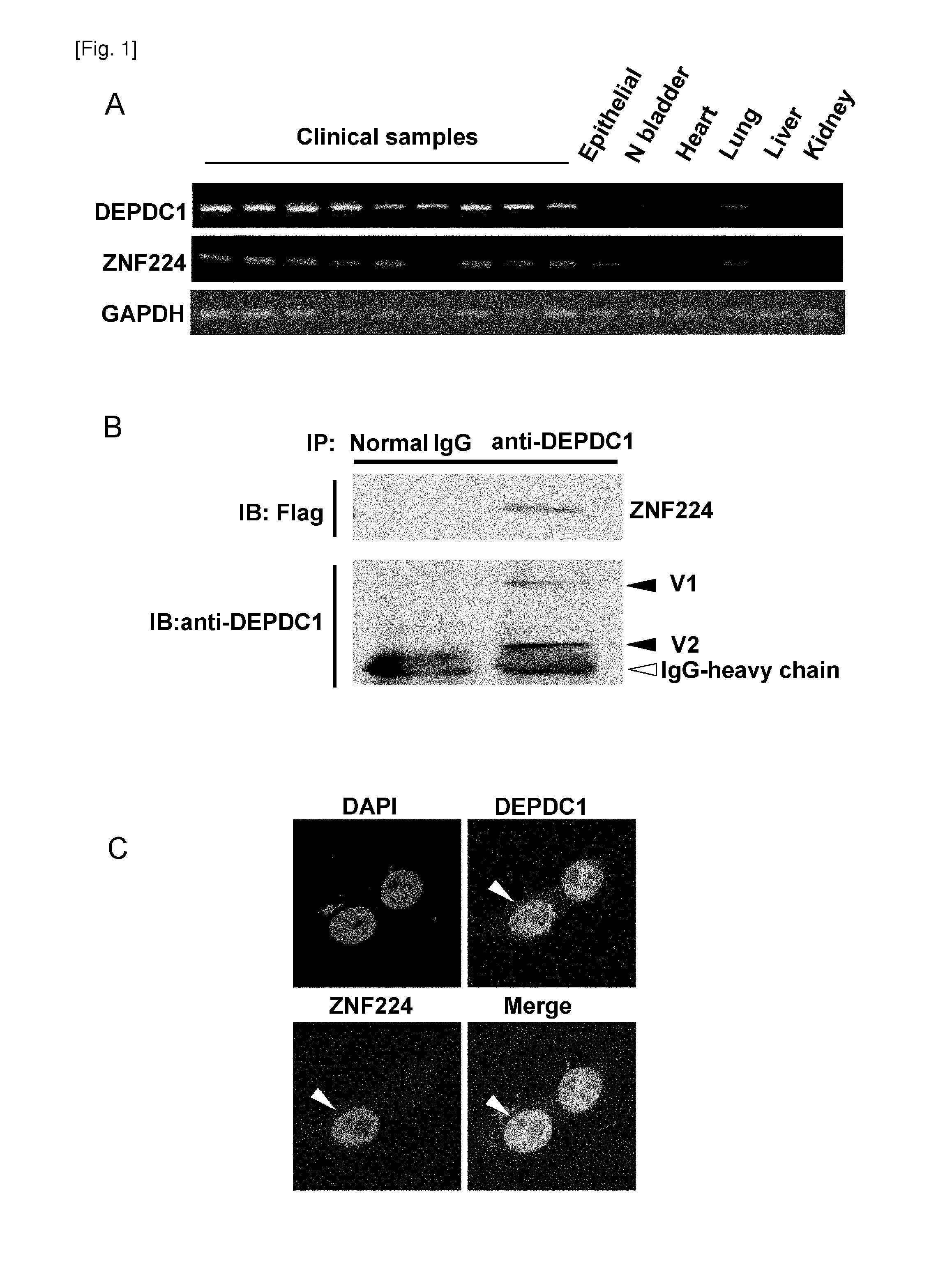 Method for treating or preventing bladder cancer using the depdc1 polypeptide