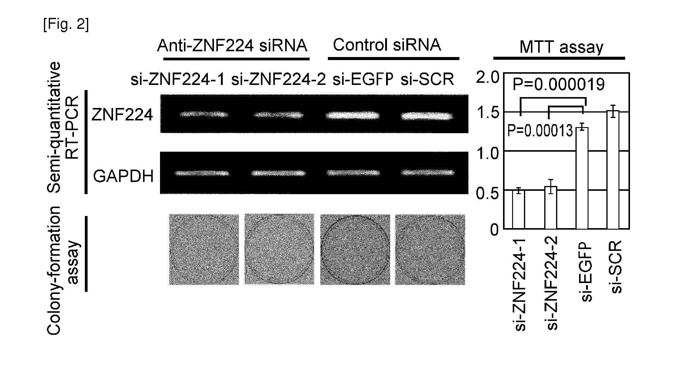 Method for treating or preventing bladder cancer using the depdc1 polypeptide