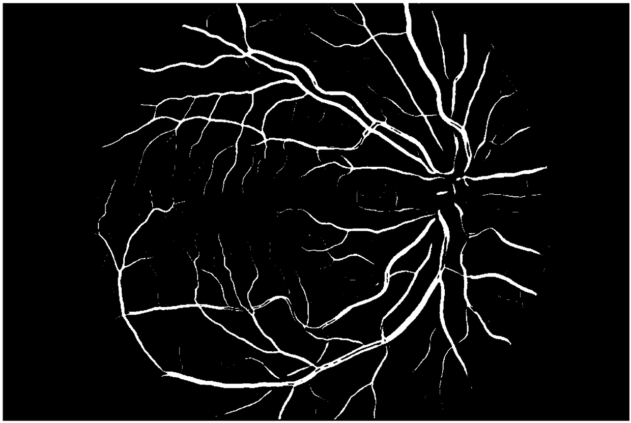 A retinal blood vessel morphology quantization method based on a connected region