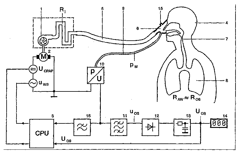 Respiration device for the treatment of sleep apnea