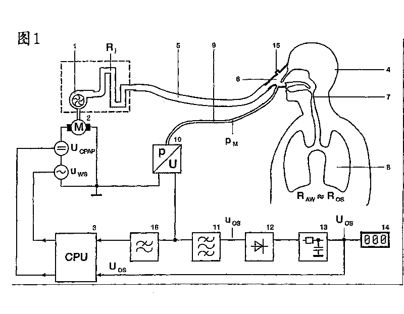 Respiration device for the treatment of sleep apnea