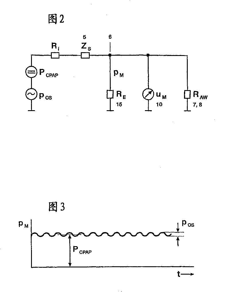 Respiration device for the treatment of sleep apnea