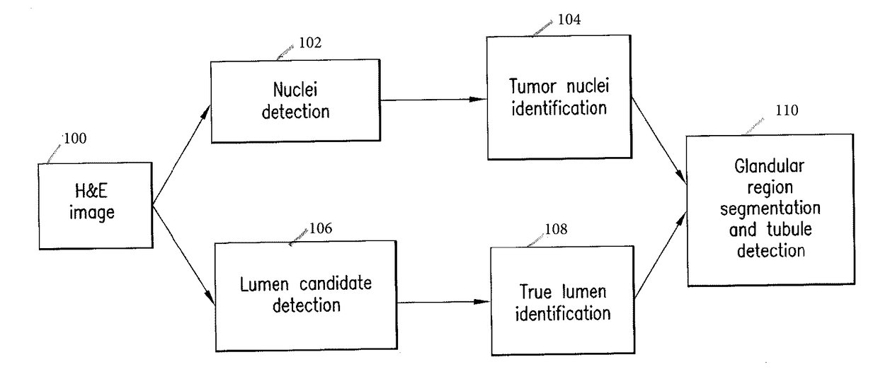 Automatic glandular and tubule detection in histological grading of breast cancer