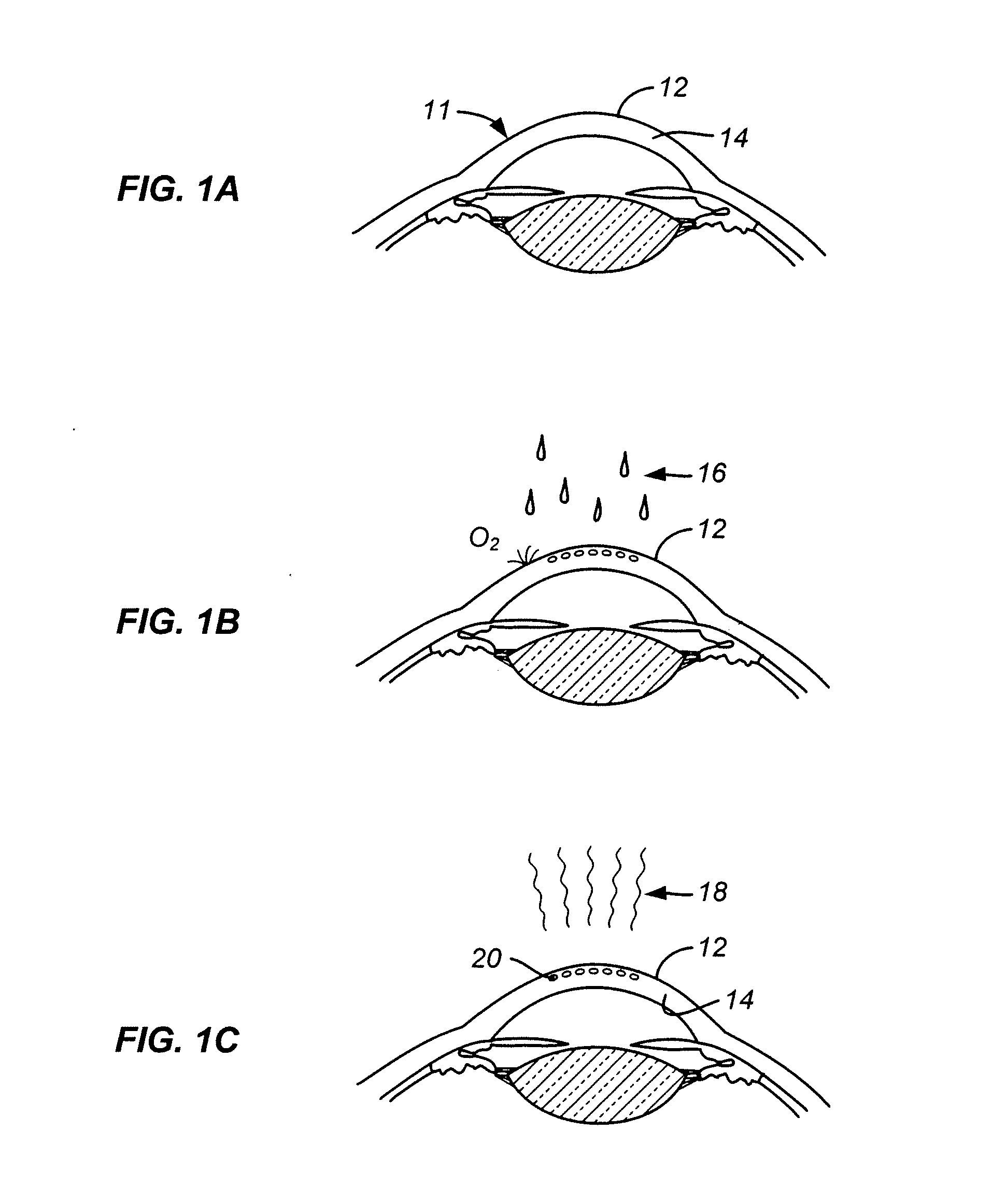 Deuterated water and riboflavin solution for extending singlet oxygen lifetimes in treatment of ocular tissue and method of use