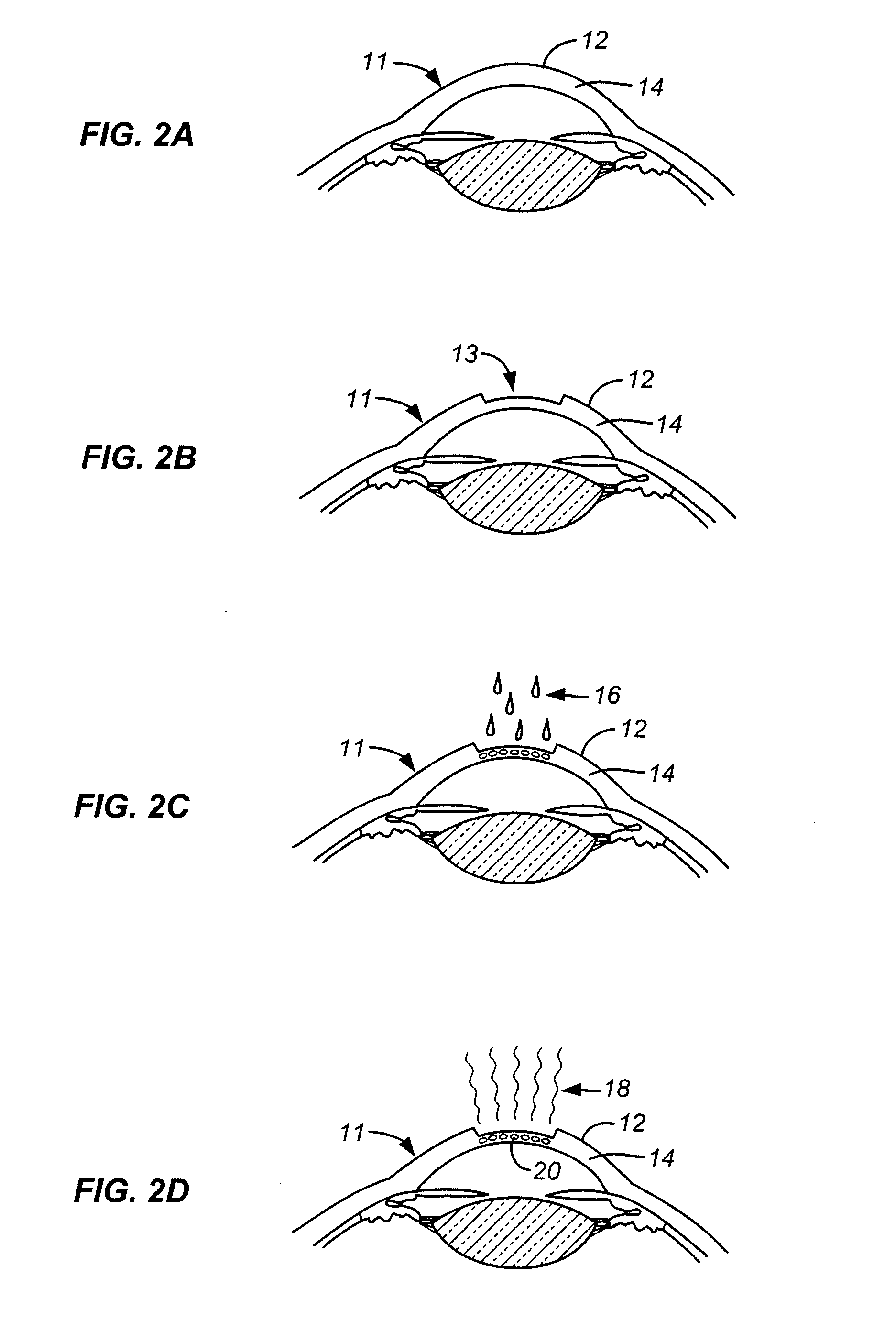 Deuterated water and riboflavin solution for extending singlet oxygen lifetimes in treatment of ocular tissue and method of use