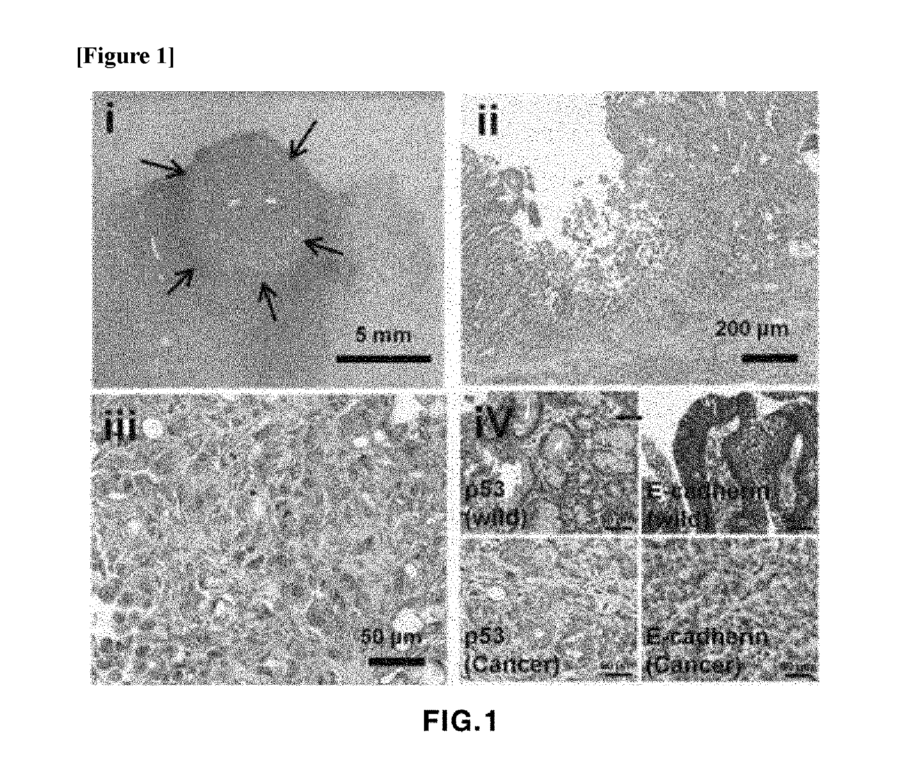 Gastric cancer cell line derived from murine gastric adenocarcinoma lacking p53 and e-cadherin and use thereof