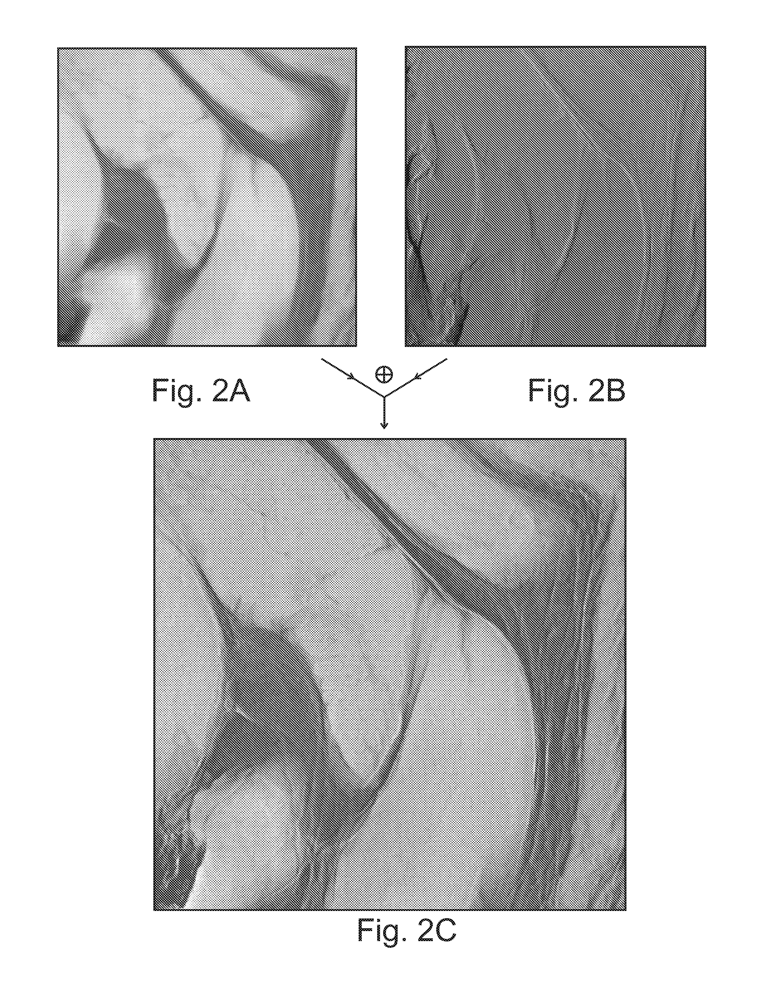 Frequency dependent combination of X-ray images of different modalities