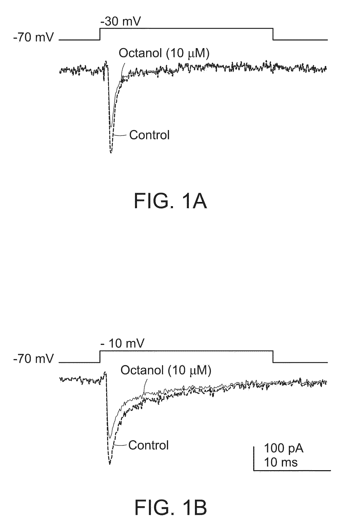 Methods and compositions for treating thalamocortical dysrhythmia