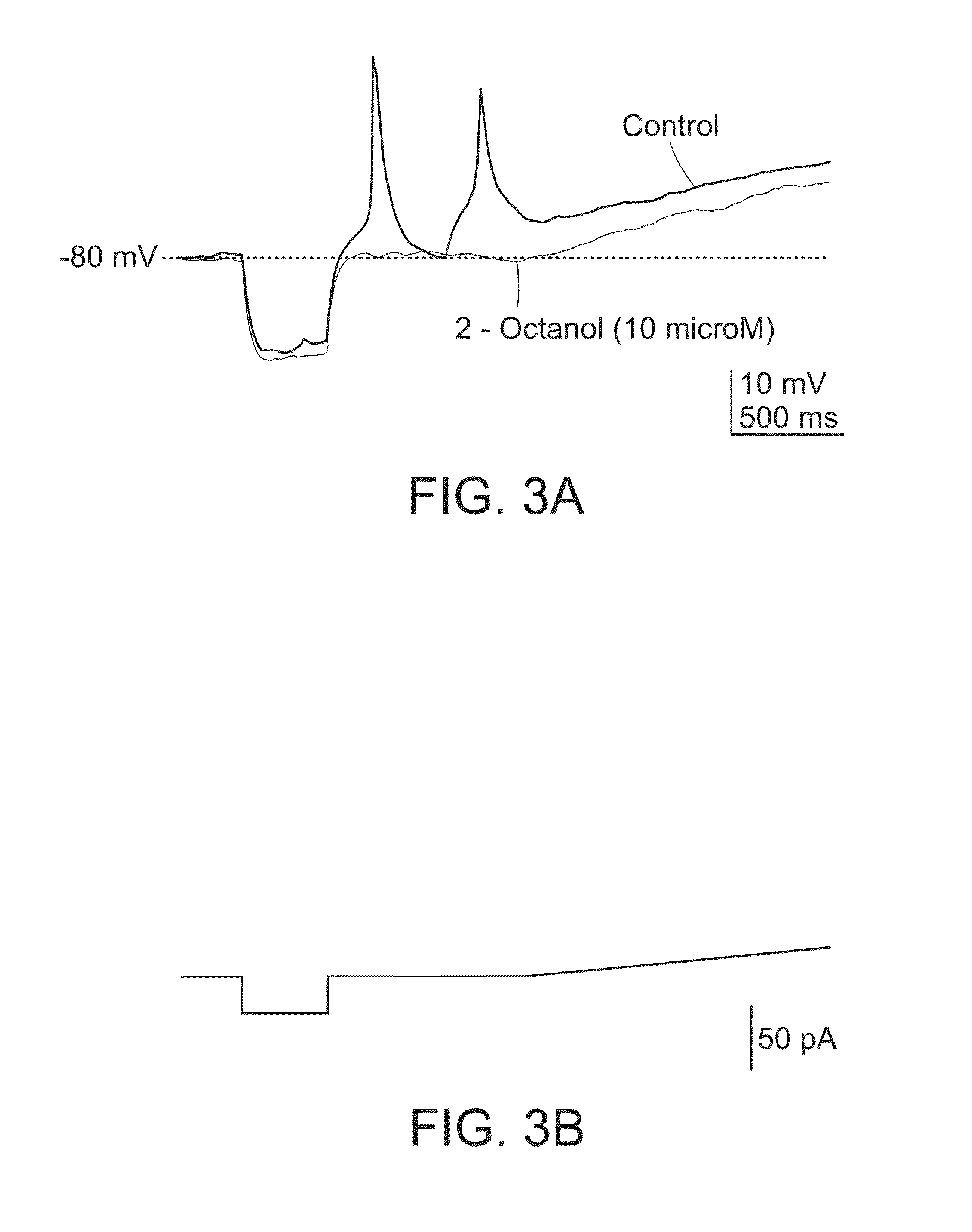 Methods and compositions for treating thalamocortical dysrhythmia