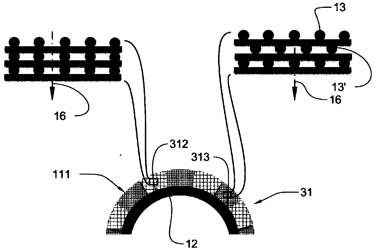 Surgical implants comprising graded porous structures