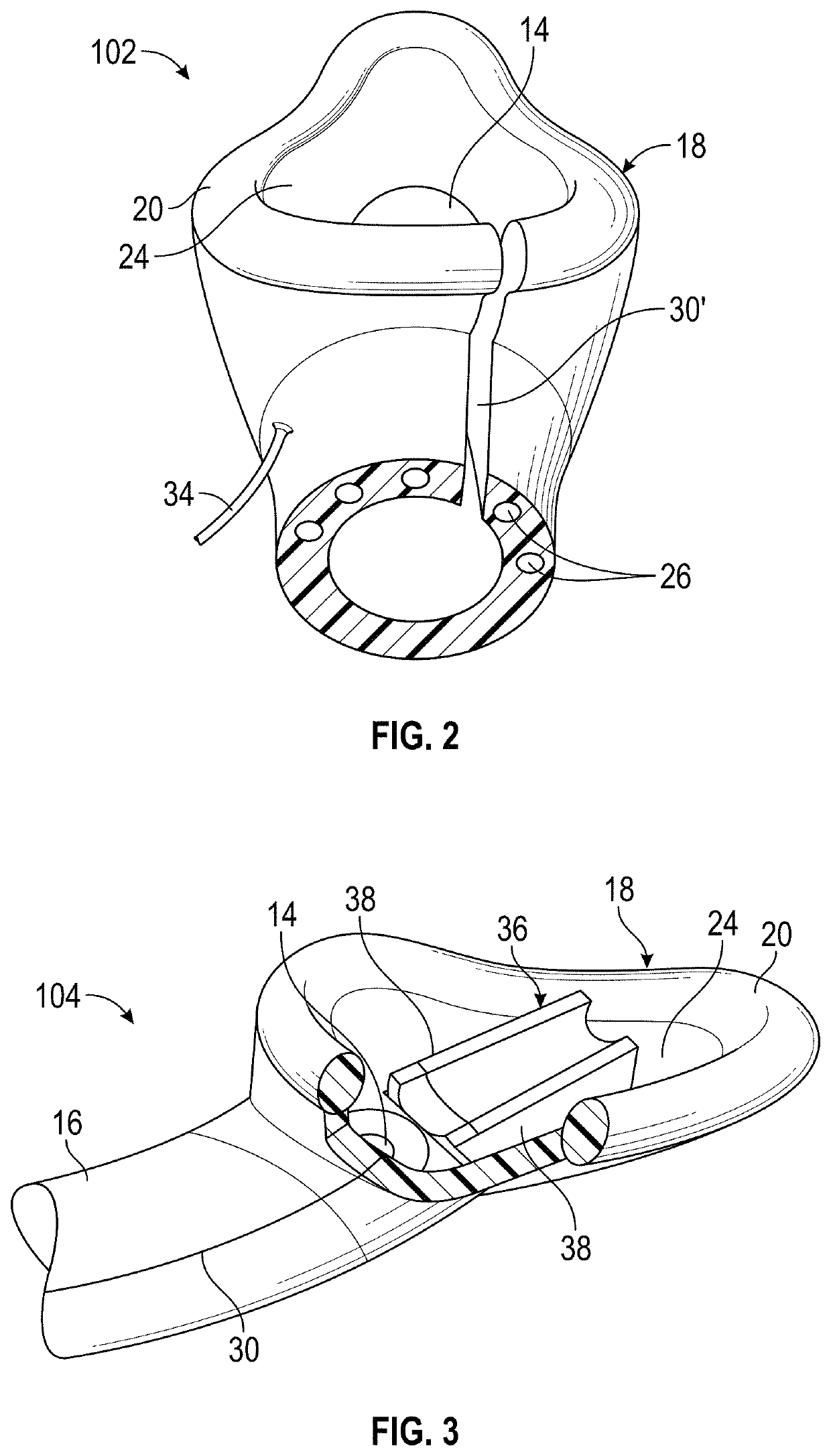 Bi-functional intubating and ventilating supraglottic airway