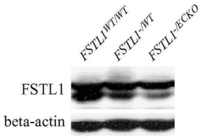 Protective effect and application of FSTL1 in anti-fibrosis steady-state regulation of tissues such as liver