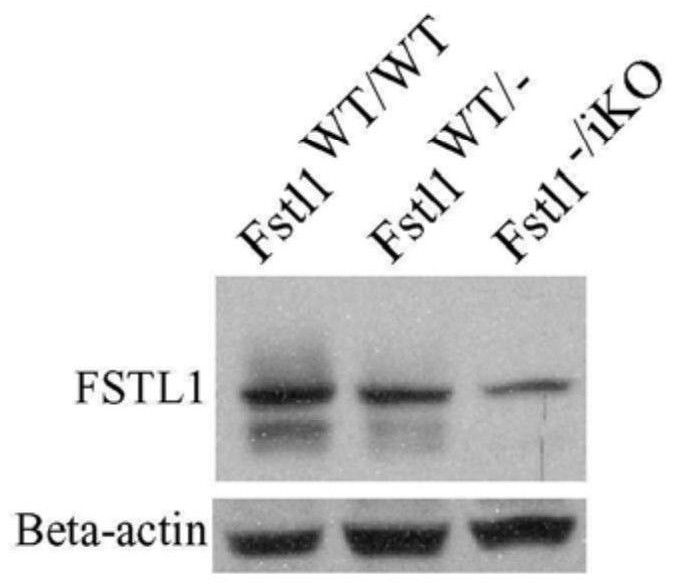 Protective effect and application of FSTL1 in anti-fibrosis steady-state regulation of tissues such as liver