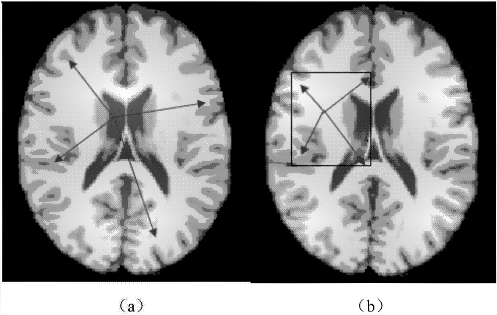 Brain magnetic resonance image super-voxel generating method based on prior knowledge