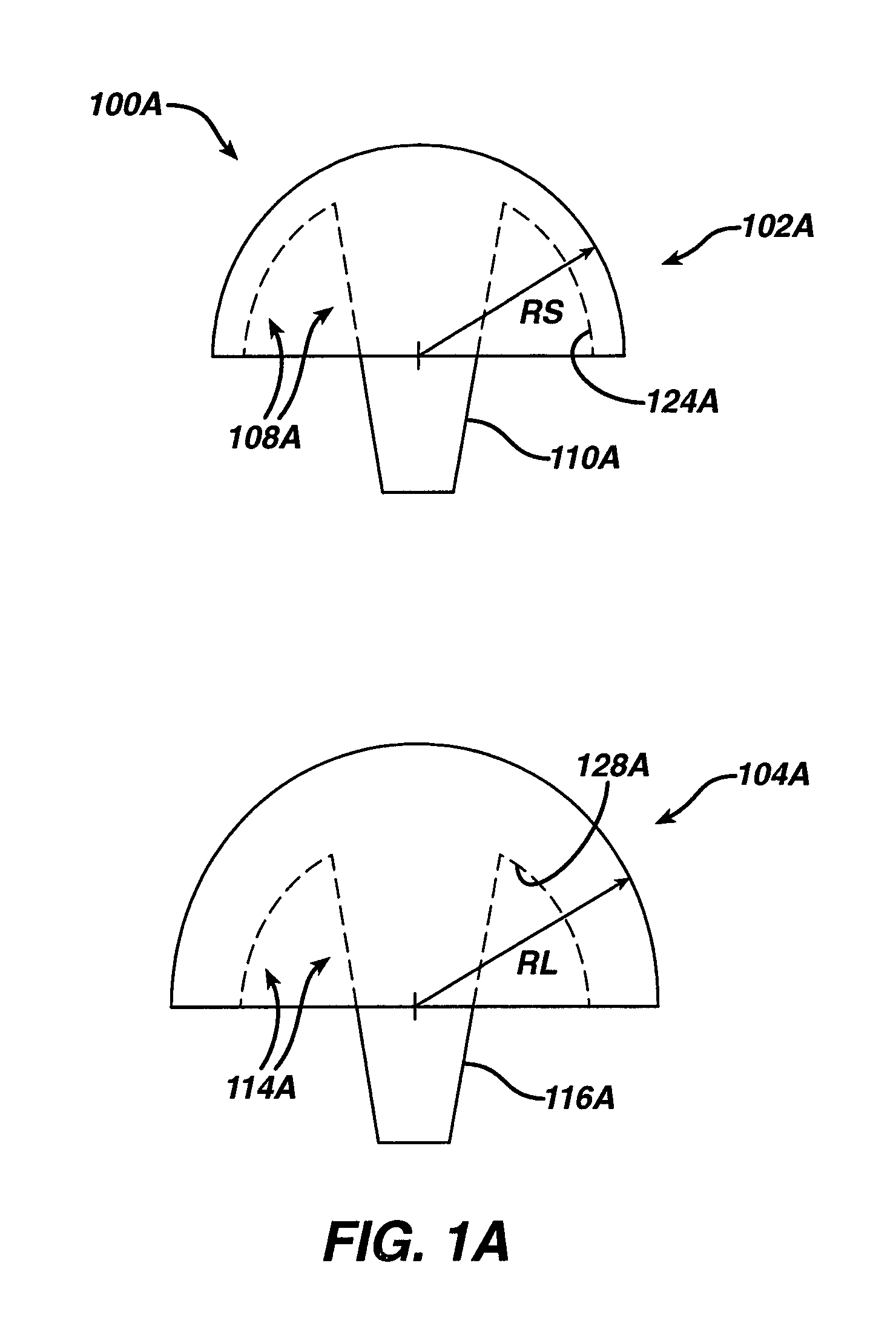 Prosthetic implant, trial and associated method