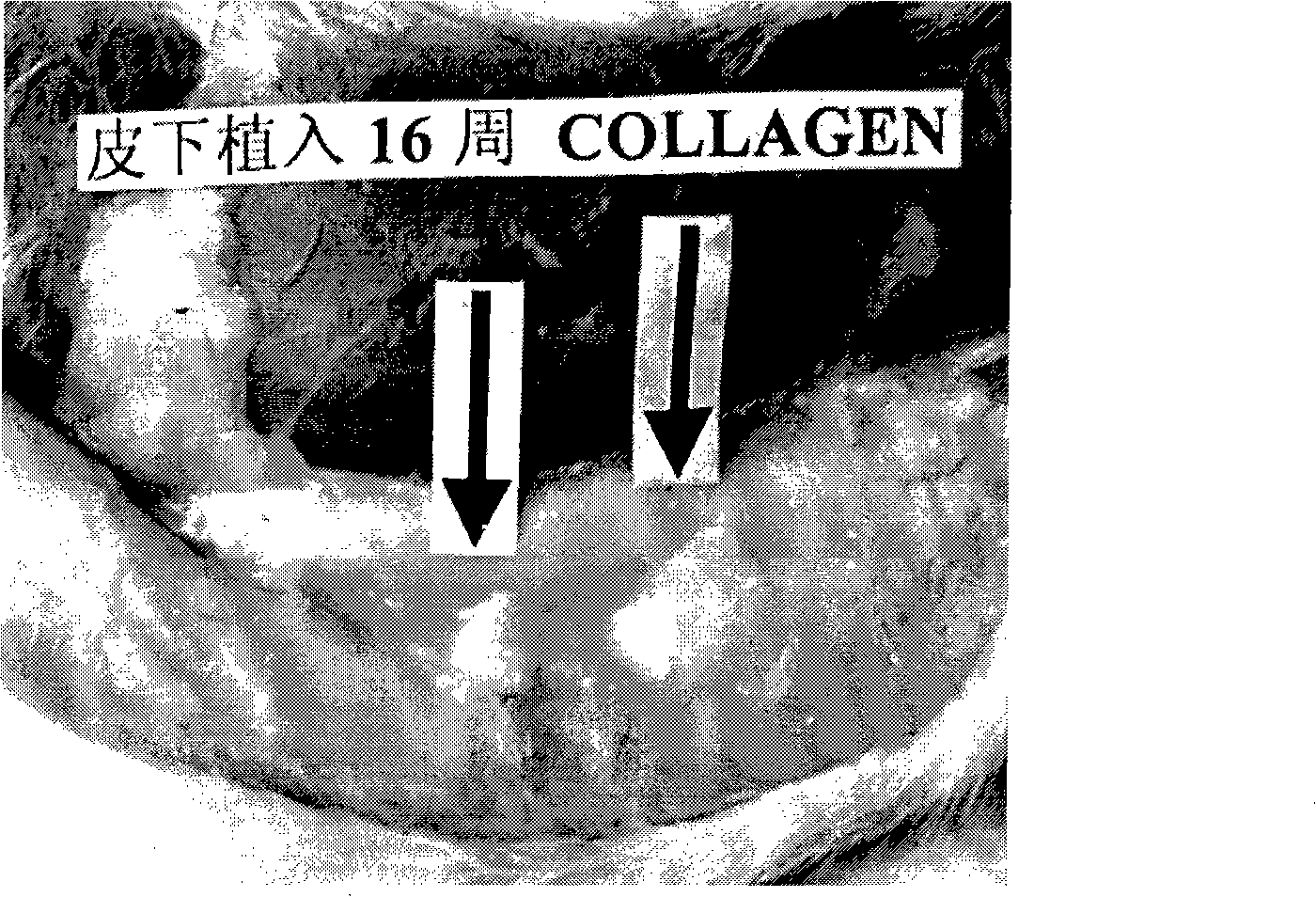 Medical grade reconstructed collagen cross-linking modified method