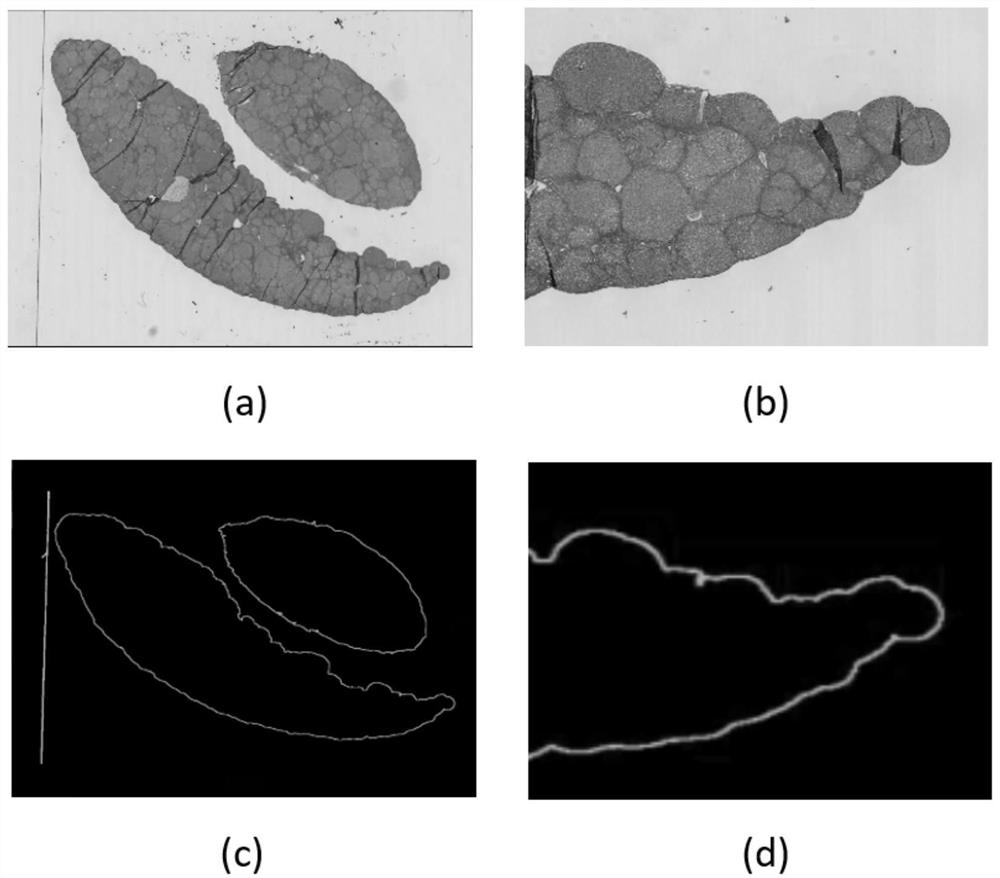 Animal lesion liver pathology image recognition method based on deep learning