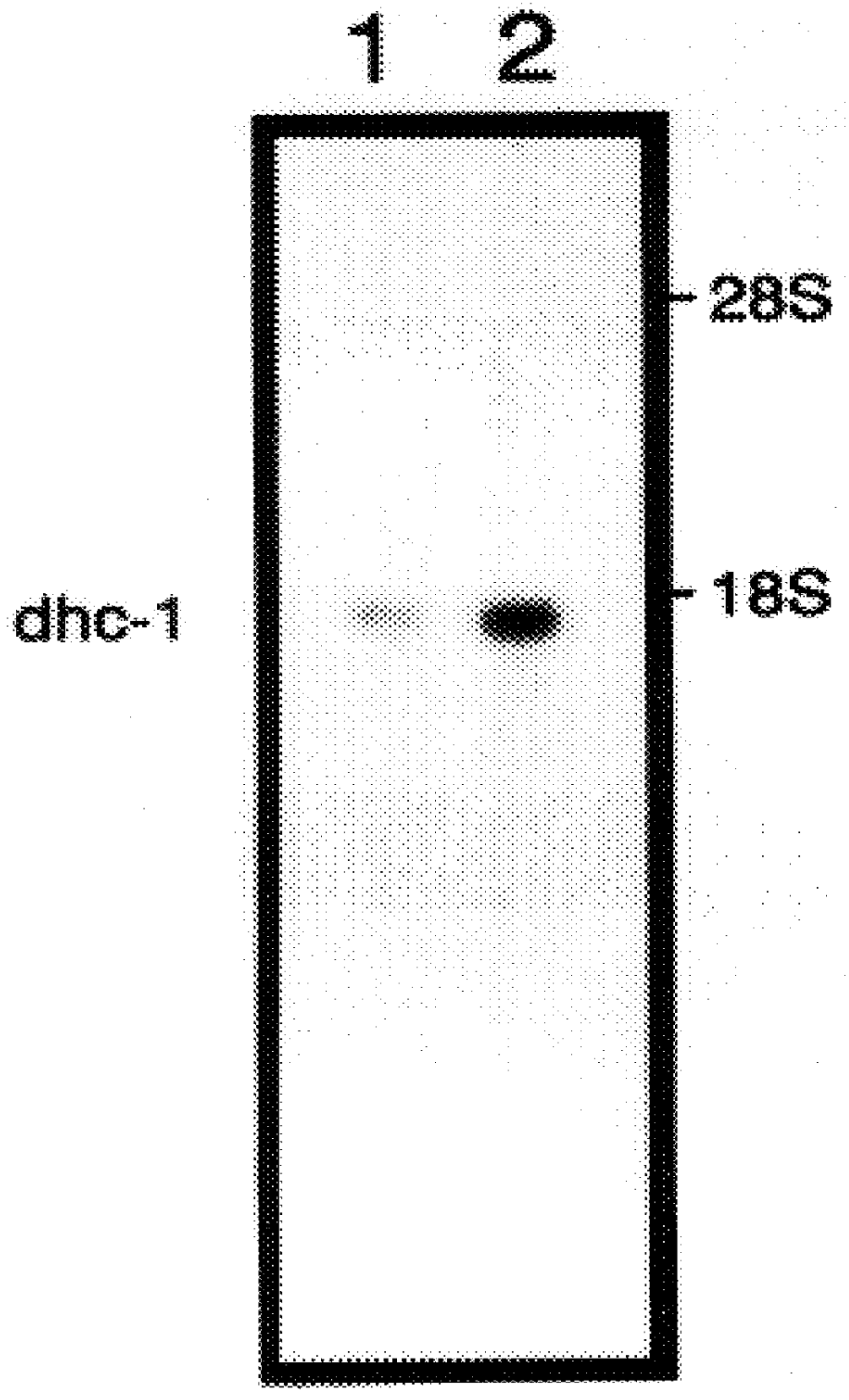 Methods and compositions for diagnosis of hyperhomocysteinemia