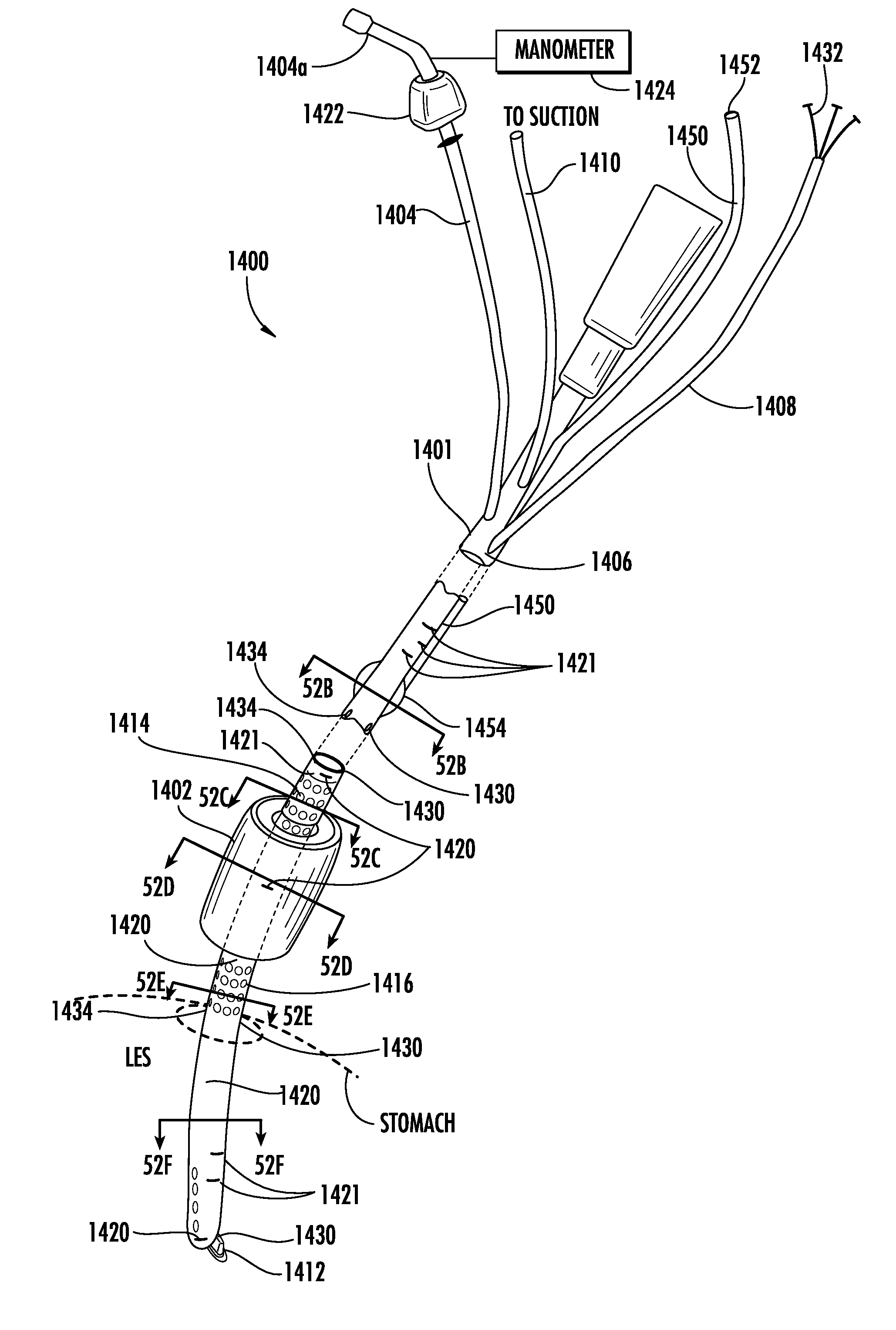 Oral-esophageal-gastric device with esophageal cuff to reduce gastric reflux and/or emesis
