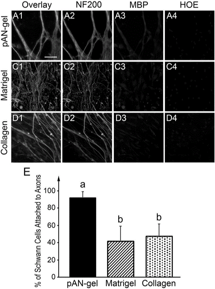 Application of acellular nerve hydrogel to preparation of peripheral nerve injury repairing composition