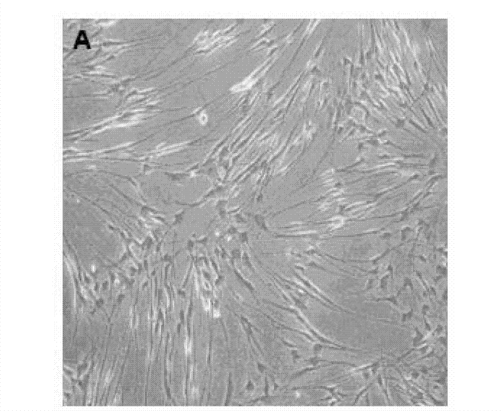 Neural restoration promoting material as well as preparation method and application thereof