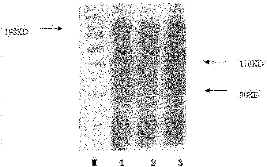 Genetic engineering kit for detecting environmental estrogen pollutants and application thereof