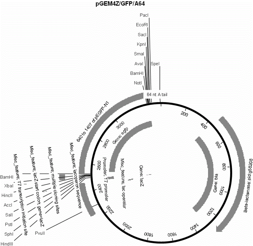 Preparation method of human T cell carrying anti-Her2/CD3 bispecific function protein